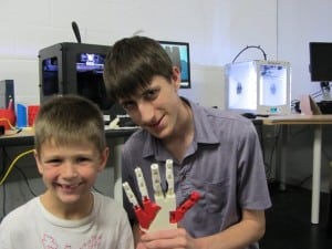 3d-printed-prosthetics