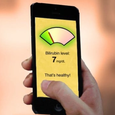 Bilicam is a smartphone application that diagnoses jaundice in newborns.