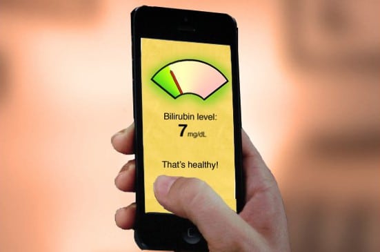 Bilicam is a smartphone application that diagnoses jaundice in newborns.