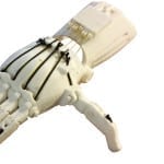 Prosthetic hand