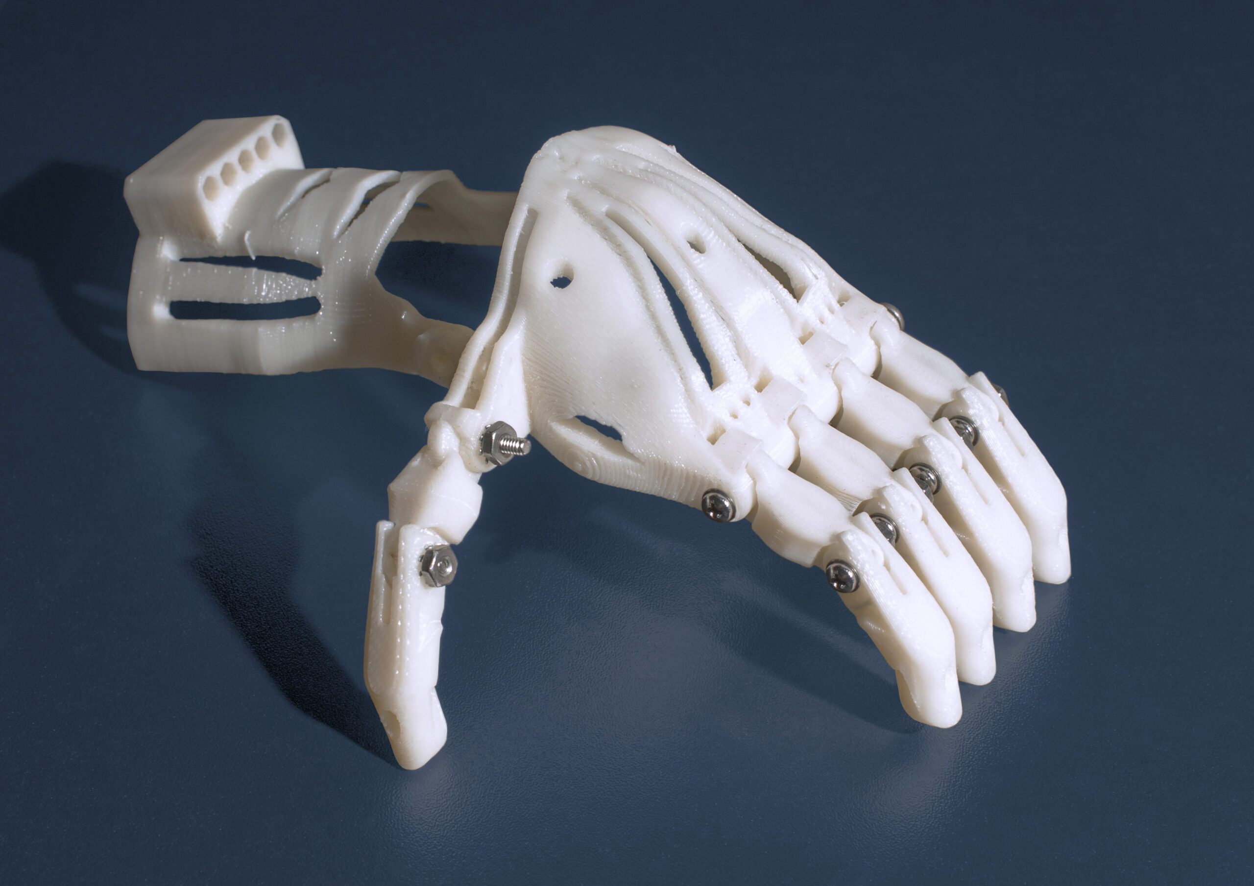 A 3d-printed prosthetic hand